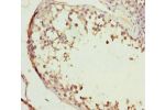 Immunohistochemistry of paraffin-embedded human