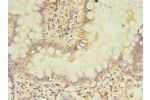 Immunohistochemistry of paraffin-embedded human small intestine tissue using CSB-PA868341LA01HU at dilution 1:100