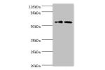 Western blot<br />
All lanes:GDAP2 antibody at 2ug/ml<br />
Lane 1:mouse liver tissue<br />
Lane 2:MCF-7 whole cell lysate<br />
Secondary<br />
Goat polyclonal to rabbit at 1/10000 dilution<br />
Predicted band size: 56kDa<br />
Observed band size: 56kDa