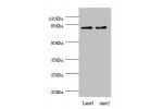 Western blot<br />
All lanes:DPP3 antibody at 1.39ug/ml<br />
Lane 1:MCF-7 whole cell lysate<br />
Lane 2:HT29 whole cell lysate<br />
Secondary<br />
Goat polyclonal to rabbit at 1/10000 dilution<br />
Predicted band size: 83,36,70,80 kDa<br />
Observed 