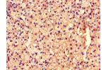 Immunohistochemistry of paraffin-embedded human adrenal gland tissue using CSB-PA868370LA01HU at dilution of 1:100