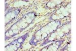 Immunohistochemistry of paraffin-embedded human rectum using CSB-PA868380DSR1HU at dilution 1:100