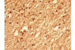 Immunohistochemistry of paraffin-embedded human brain tissue using CSB-PA868394LA01HU at dilution of 1:100