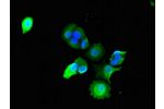 Immunofluorescent analysis of MCF-7 cells using CSB-PA868397LA01HU at a dilution of 1:100 and Alexa Fluor 488-congugated AffiniPure Goat Anti-Rabbit IgG(H+L)