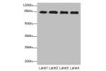 Western blot<br />
All lanes: