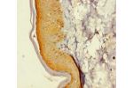 Immunohistochemistry of paraffin-embedded human skin tissue using CSB-PA871563LA01HU at dilution 1:100