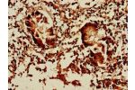 Immunohistochemistry of paraffin-embedded human appendix tissue using CSB-PA871573LA01HU at dilution of 1:100