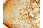 Immunohistochemistry of paraffin-embedded human skin tissue using CSB-PA871599EA01HU at dilution 1:100