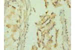 Immunohistochemistry of paraffin-embedded human prostate tissue using CSB-PA871864DSR2HU at dilution 1:100