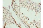 Immunohistochemistry of paraffin-embedded human testis tissue using CSB-PA872418LA01HU at dilution of 1:100