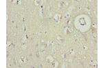 Immunohistochemistry of paraffin-embedded human brain tissue using CSB-PA872507ESR2HU at dilution 1:100