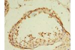 Immunohistochemistry of paraffin-embedded human testis tissue using CSB-PA872517LA01HU at dilution of 1:100