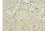 Immunohistochemistry of paraffin-embedded human liver tissue using CSB-PA872524LA01HU at dilution of 1:100