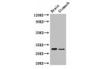 Western Blot<br />
Positive WB detected in:Mouse brain tissue,Mouse stomach tissue<br />
All lanes: COPS7B antibody at 3ug/ml<br />
Secondary<br />
Goat polyclonal to rabbit IgG at 1/50000 dilution<br />
Predicted band size: 30,19,31 kDa<br />
Observed ba