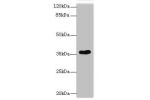 Western blot<br />
All lanes: CAB39L antibody at 10ug/ml+ 293T whole cell lysate<br />
Goat polyclonal to rabbit at 1/10000 dilution<br />
Predicted band size: 39 kDa<br />
Observed band size: 39 kDa<br />