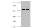 Western blot<br />
All lanes:CYP4F11 antibody at 2ug/ml<br />
Lane 1:mouse liver tissue<br />
Lane 2:mouse kidney tissue<br />
Secondary<br />
Goat polyclonal to rabbit at 1/10000 dilution<br />
Predicted band size: 60kDa<br />
Observed band size: 60kDa<b