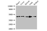 Western Blot<br />
Positive WB detected in:Mouse heart tissue,Mouse liver tissue,Mouse spleen tissue,Mouse lung tissue,Mouse kidney tissue<br />
All lanes:CD209 antibody at 4