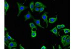 Immunofluorescent analysis of HepG2 cells using CSB-PA873608LA01HU at a dilution of 1:100 and Alexa Fluor 488-congugated AffiniPure Goat Anti-Rabbit IgG(H+L)