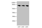 Western blot<br />
All lanes: