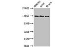 Western Blot<br />
Positive WB detected in:HEK293 whole cell lysate,A549 whole cell lysate,Mouse brain tissue<br />
All lanes:EIF4ENIF1 antibody at 2.7