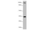 Western blot<br />
All lanes:FBXO6 antibody at 3.87 ug/ml+ A431 whole cell lysate<br />
Secondary<br />
Goat polyclonal to rabbit IgG at 1/10000 dilution<br />
Predicted band size: 34 kDa<br />
Observed band size: 34120 kDa<br />