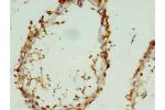 Immunohistochemistry of paraffin-embedded human testis using CSB-PA873640LA01HU at dilution of 1:100