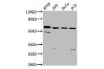 Western Blot<br />
Positive WB detected in:A549 whole cell lysate,293 whole cell lysate,Hela whole cell lysate,PC3 whole cell lysate<br />
All lanes:DDX28 antibody at 6.1