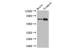 Western Blot<br />
Positive WB detected in:Mouse brain tissue,Mouse stomach tissue<br />
All lanes: EXD2 antibody at 2.8ug/ml<br />
Secondary<br />
Goat polyclonal to rabbit IgG at 1/50000 dilution<br />
Predicted band size: 71,57 kDa<br />
Observed band 