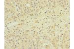 Immunohistochemistry of paraffin-embedded human adrenal gland tissue using CSB-PA873675LA01HU at dilution of 1:100