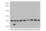 Western blot<br />
All lanes:CHCHD3 antibody at 0.56 ug/ml<br />
Lane 1 : Mouse heart tissue<br />
Lane 2 : Mouse kidney tissue<br />
Lane 3 : Mouse lung tissue<br />
Lane 4 : Human placenta tissue<br />
Lane 5 : A549 whole cell lysate<br />
Lane 6 : HepG