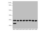 Western blot<br />
All lanes:CHCHD3 antibody at 1.67 ug/ml<br />
Lane 1 : Mouse kidney tissue<br />
Lane 2 : Mouse lung tissue<br />
Lane 3 : Human placenta tissue<br />
Lane 4 : A549 whole cell lysate<br />
Lane 5 : HepG-2 whole cell lysate<br />
Lane 6 
