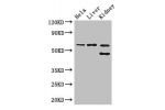 Western Blot<br />
Positive WB detected in:Hela whole cell lysate,Mouse liver tissue,Mouse kidney tissue<br />
All lanes: EHD2 antibody at 3ug/ml<br />
Secondary<br />
Goat polyclonal to rabbit IgG at 1/50000 dilution<br />
Predicted band size: 62,47 kDa<