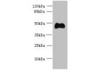 Western blot<br />
All lanes: ABI3 antibody at 5ug/ml+Mouse heart tissue<br />
Goat polyclonal to rabbit at 1/10000 dilution<br />
Predicted band size: 40,39 kDa<br />
Observed band size: 39 kDa<br />