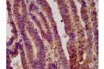 IHC image of CSB-PA874786LA01HU diluted at 1:800 and staining in paraffin-embedded human colon cancer performed on a Leica BondTM system. After dewaxing and hydration, antigen retrieval was mediated by high pressure in a citrate buffer (pH 6.0). Section w