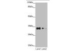 Western blot<br />
All lanes: CNPY3 antibody at 1.2ug/ml<br />
Lane 1 : HepG-2 whole cell lysate<br />
Lane 2 : MCF7 whole cell lysate<br />
Secondary<br />
Goat polyclonal to Rabbit IgG at 1/10000 dilution<br />
Predicted band size: 31,6 kDa<br />
Observ
