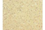 Immunohistochemistry of paraffin-embedded human liver tissue using CSB-PA874814LA01HU at dilution of 1:100