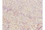 Immunohistochemistry of paraffin-embedded human tonsil tissue using CSB-PA874826LA01HU at dilution of 1:100