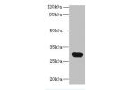 Western blot<br />
All lanes: C1QTNF6 antibody at 8ug/ml+Mouse brain tissue<br />
Goat polyclonal to rabbit at 1/10000 dilution<br />
Predicted band size: 29,31,18 kDa<br />
Observed band size: 29 kDa<br />