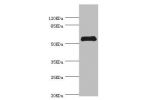 Western blot<br />
All lanes:CHIA antibody at 0.74ug/ml+mouse stomach tissue<br />
Secondary<br />
Goat polyclonal to rabbit at 1/10000 dilution<br />
Predicted band size: 53,41,34 kDa<br />
Observed band size: 52 kDa<br />