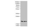 Western blot<br />
All lanes: C20orf27 antibody at 6ug/ml<br />
Lane 1 : HCT116 whole cell lysate<br />
Lane 2 : MDA-MB-231 whole cell lysate<br />
Secondary<br />
Goat polyclonal to Rabbit IgG at 1/10000 dilution<br />
Predicted band size: 20,22 kDa<br /