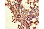 Immunohistochemistry of paraffin-embedded human lung tissue using CSB-PA875651LA01HU at dilution 1:100