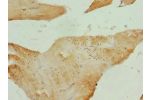 Immunohistochemistry of paraffin-embedded human skeletal muscle tissue using CSB-PA875656ESR2HU at dilution 1:100