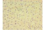Immunohistochemistry of paraffin-embedded human liver tissue using CSB-PA875664LA01HU at dilution 1:100