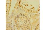 Immunohistochemistry of paraffin-embedded human testis tissue using CSB-PA875677LA01HU at dilution of 1:100