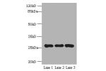 Western blot<br />
All lanes:EXOSC5 antibody at 5ug/ml<br />
Lane 1:K562 whole cell lysate<br />
Lane 2:293T whole cell lysate<br />
Lane 3:Hela whole cell lysate<br />
Secondary<br />
Goat polyclonal to rabbit at 1/10000 dilution<br />
Predicted band siz