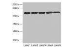Western blot<br />
All lanes: ARHGEF3 antibody at 2.21ug/ml<br />
Lane 1 : MCF7 whole cell lysate<br />
Lane 2 : HepG-2 whole cell lysate<br />
Lane 3 : Jurkat whole cell lysate<br />
Lane 4 : Hela whole cell lysate<br />
Lane 5 : 293T whole cell lysate<b