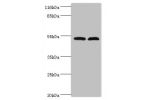 Western blot<br />
All lanes:Protein FAM114A2 antibody at 2ug/ml<br />
Lane 1:mouse kidney tissue<br />
Lane 2:U251 whole cell lysate<br />
Secondary<br />
Goat polyclonal to rabbit at 1/10000 dilution<br />
Predicted band size: 55kDa<br />
Observed band 
