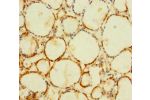 Immunohistochemistry of paraffin-embedded human thyroid tissue using CSB-PA878881LA01HU at dilution of 1:100