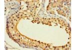 Immunohistochemistry of paraffin-embedded human testis tissue using CSB-PA878898LA01HU at dilution of 1:100
