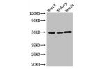 Western Blot<br />
Positive WB detected in:Mouse heart tissue,Mouse kidney tissue,Mouse brain tissue<br />
All lanes: ANKRD10 antibody at 4ug/ml<br />
Secondary<br />
Goat polyclonal to rabbit IgG at 1/50000 dilution<br />
Predicted band size: 45,24 kDa<b